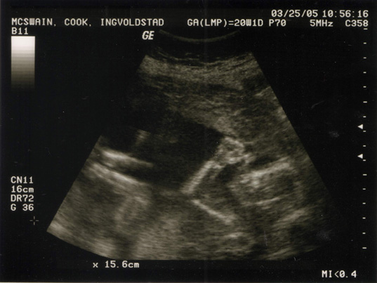 ultrababy